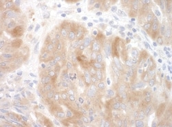 SRPK2 Antibody, Novus Biologicals 0.1mL; Unlabeled:Antibodies, Polyclonal